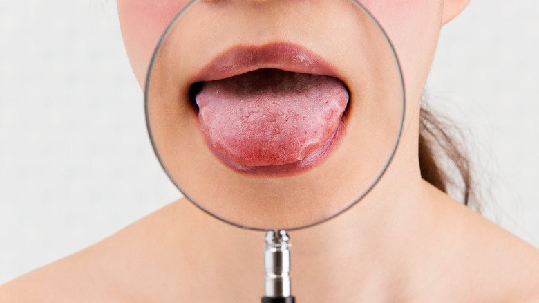 Closeup of woman's tongue viewed through a magnifying glass