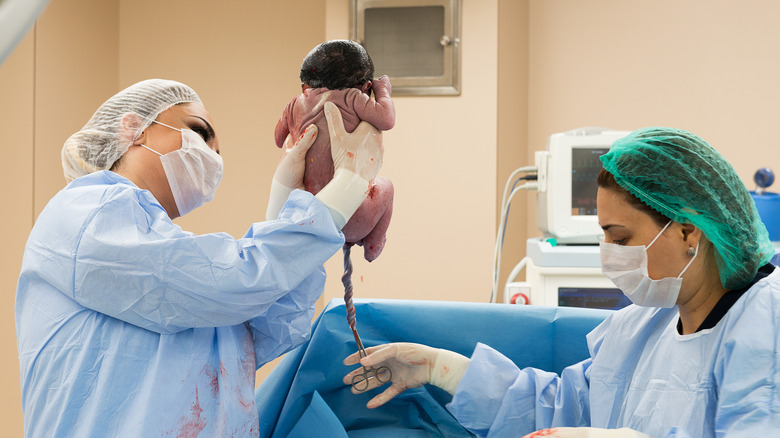 Newborn baby with umbilical cord