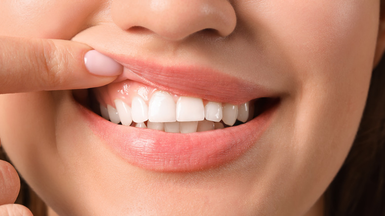 woman showing her teeth