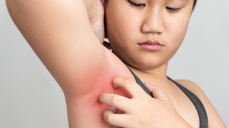 Woman scratching her armpit causing redness