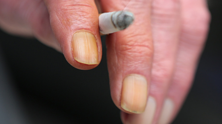 smoking-stained fingernails