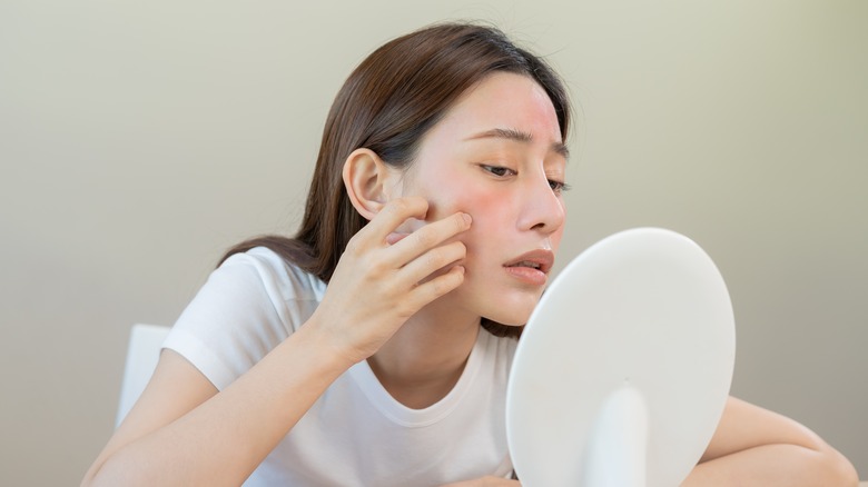 lady looking at eczema on her face in mirror