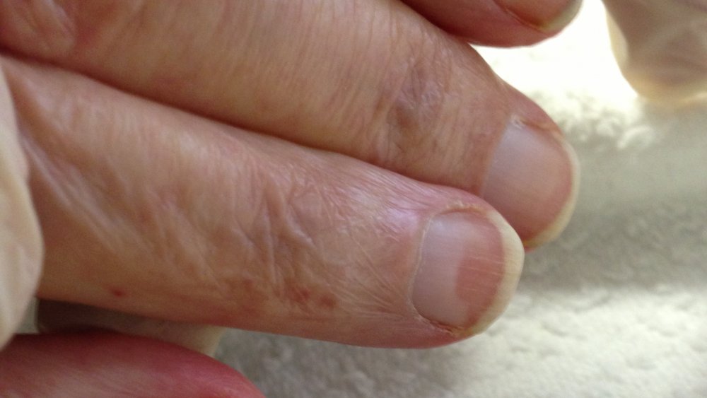 The Surprising Things Your Fingernails Can Tell You About Your Health