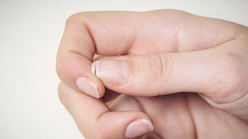 The Surprising Things Your Fingernails Can Tell You About Your Health