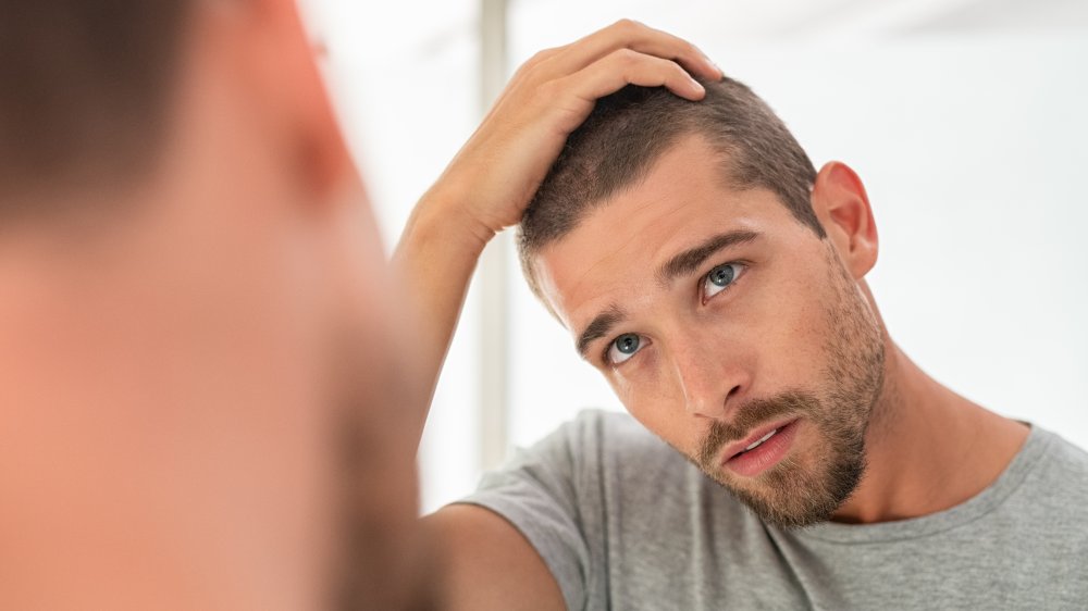 man worried about hair loss