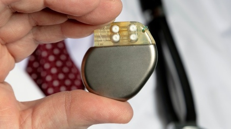 pacemaker heart implant