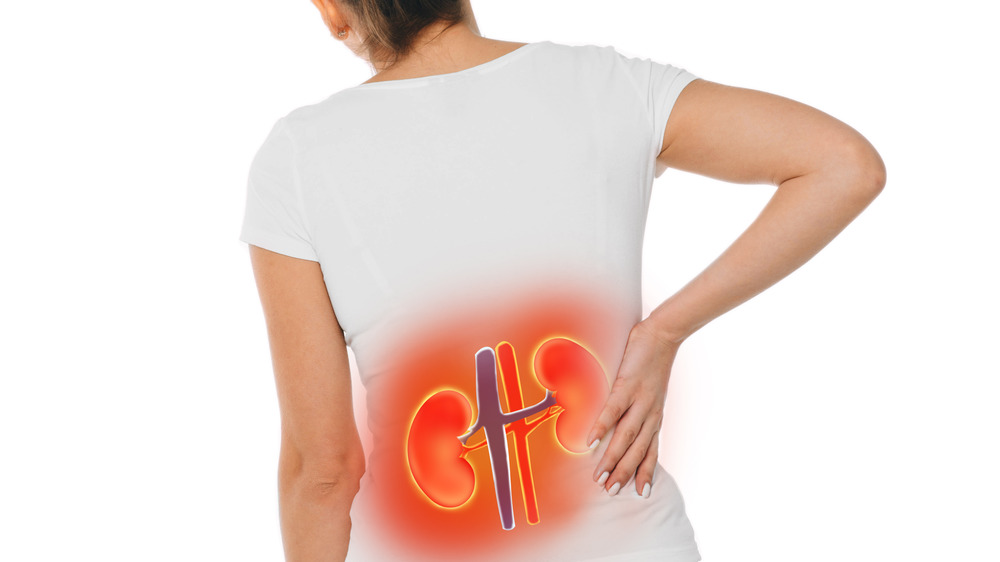 Woman displaying kidney pain