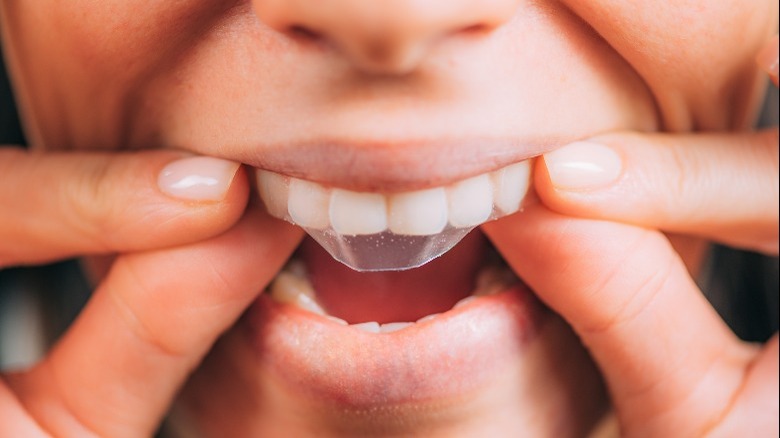 placing whitening strip on teeth