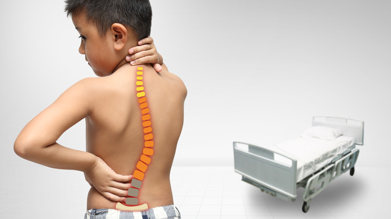 boy with scoliosis