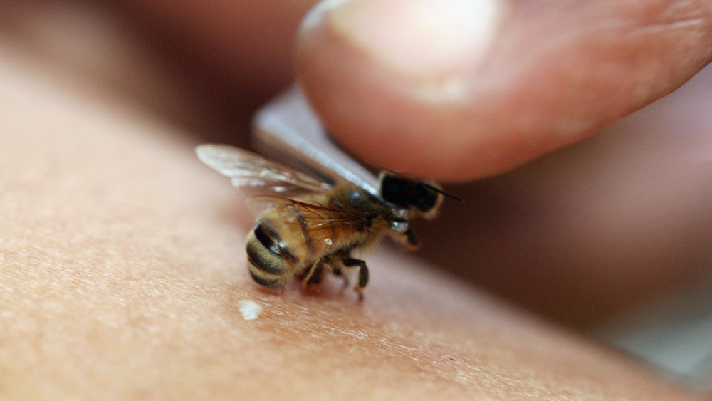 apitherapy, bee stinging arm