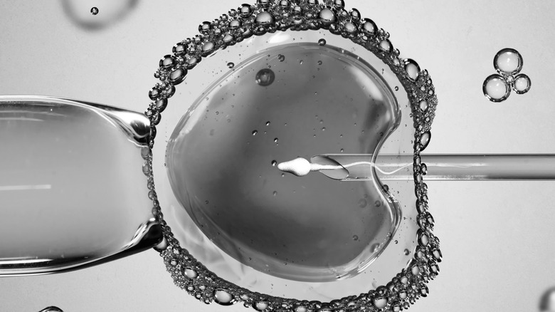 sperm being inserted into ovum during IVF