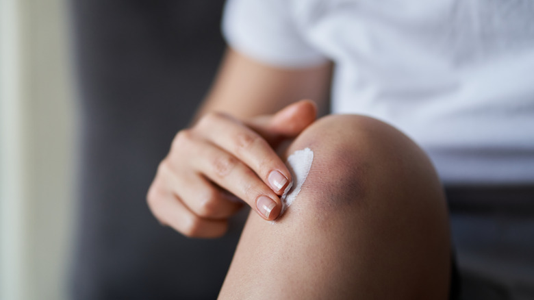 Applying cream to bruised knee