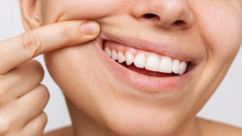 young woman showing healthy gums