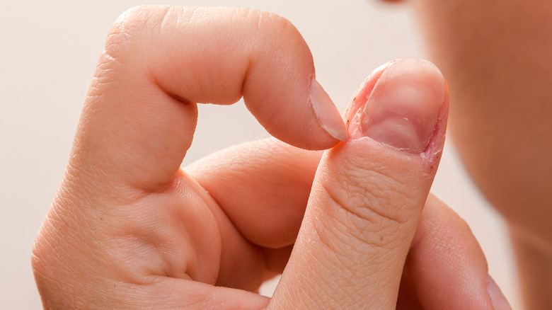 person picking nails painfully