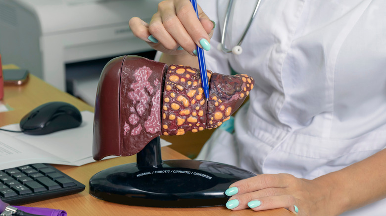 doctor points to liver model