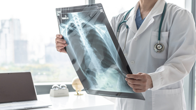 doctor holding chest x-ray