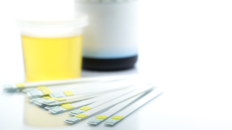 urinalysis and test 