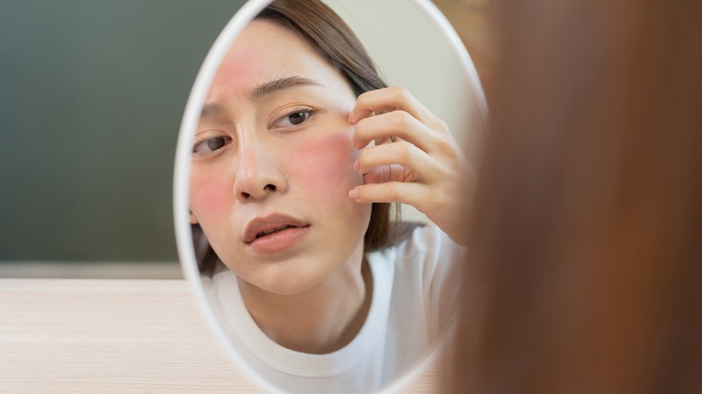 woman with dry skin