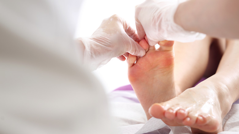 dermatologist treating a nail fungus on the foot 