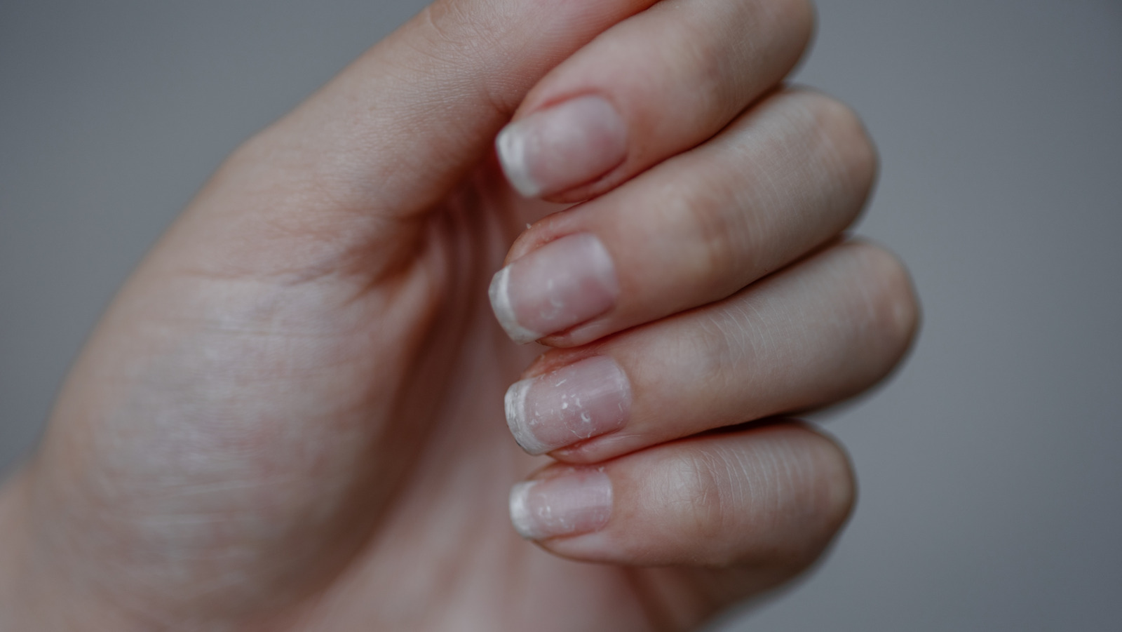 This Is What Really Causes Brittle Nails