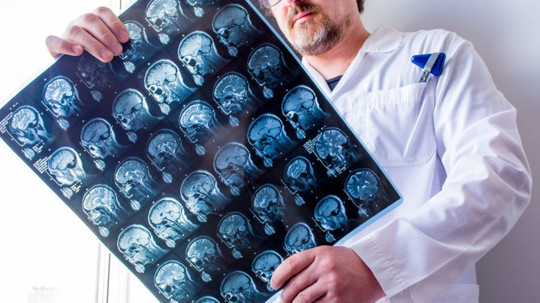 Doctor looks at X-rays of brains