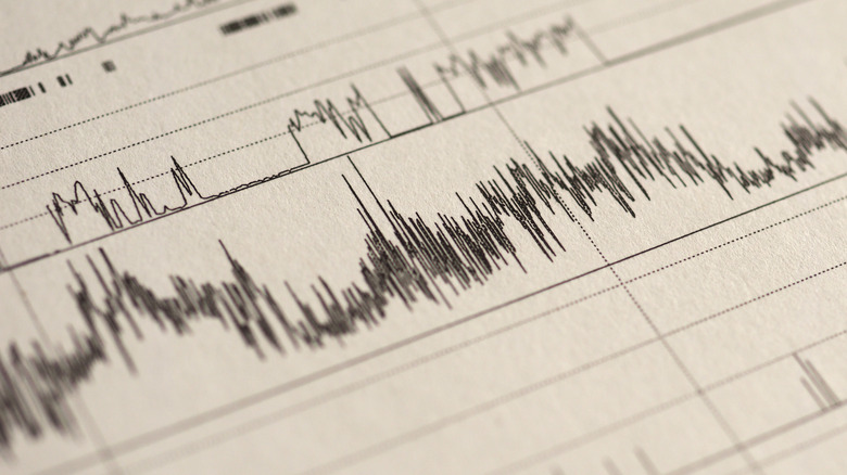 Chart of polysomnography results on paper