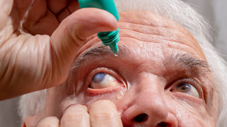 An older man putting eye drops in his eye