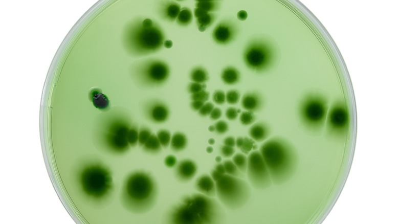 petri dish with green microbes