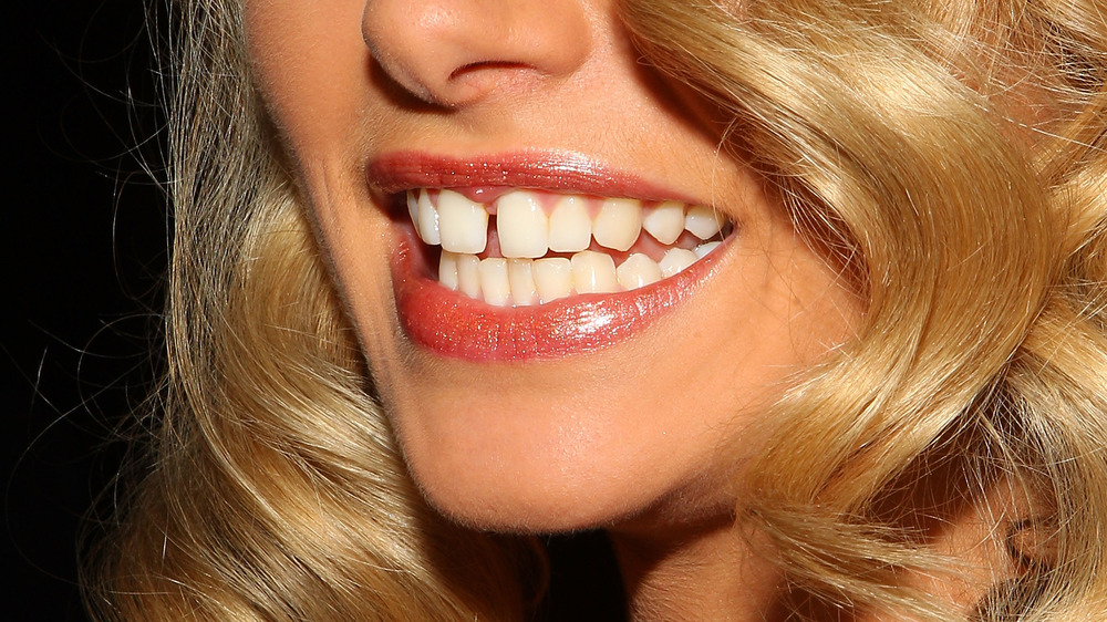 Gap Tooth Beauty