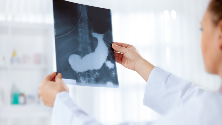 Doctor holding x-ray image of pancreas