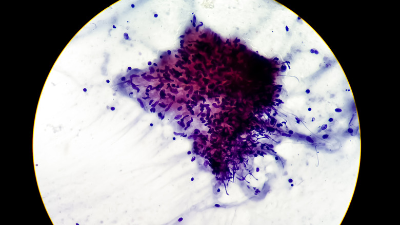 Mycobacterium tuberculosis cells