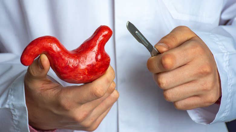 doctor holding scalpel and stomach model