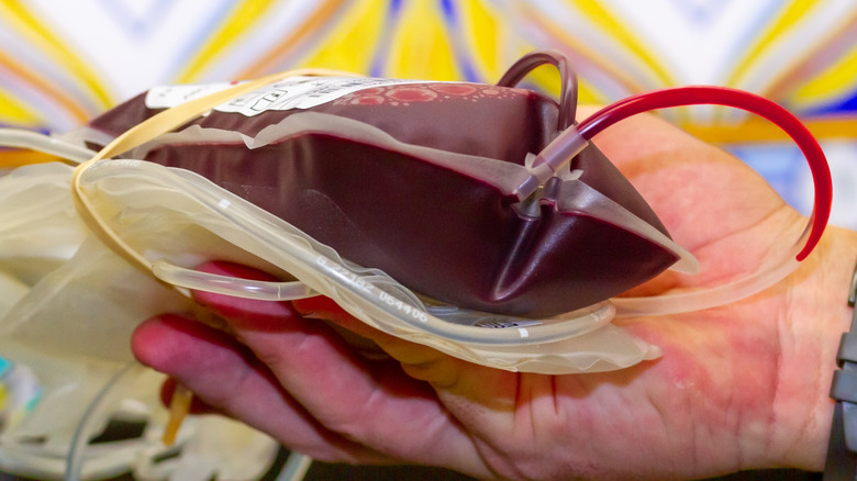 hand holding a bag of transfused red blood cells