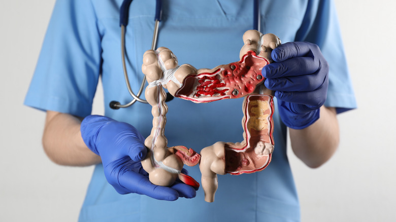 Nurse holding human colon model