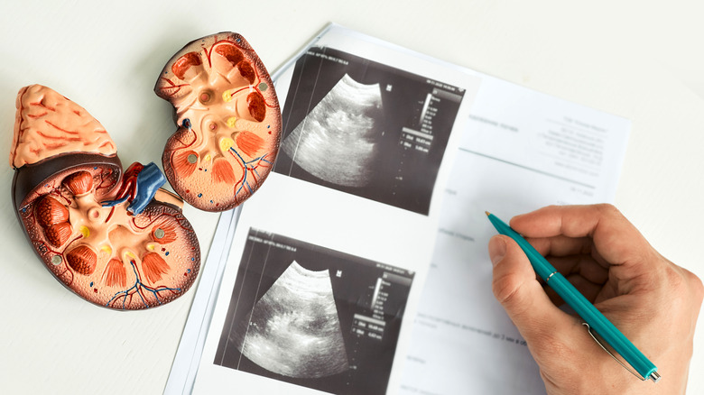 kidney models beside ultrasound 