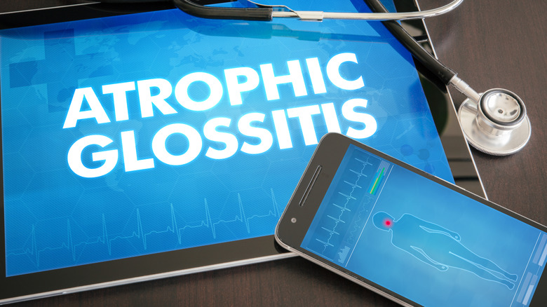 Image to represent diagnosis of atrophic glossitis