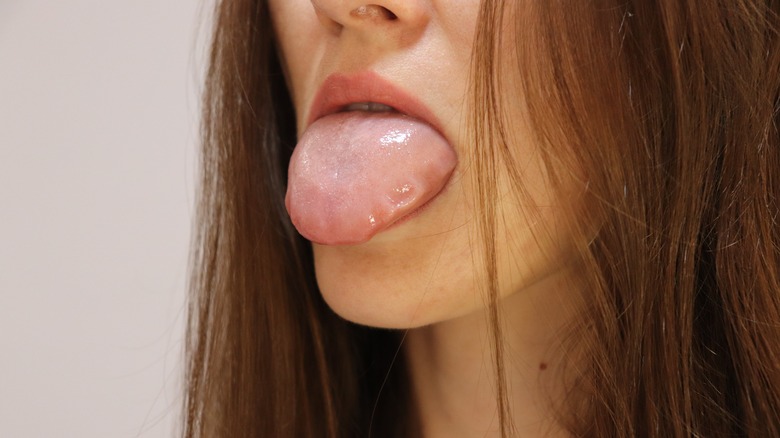 Image to represent a woman's swollen tongue