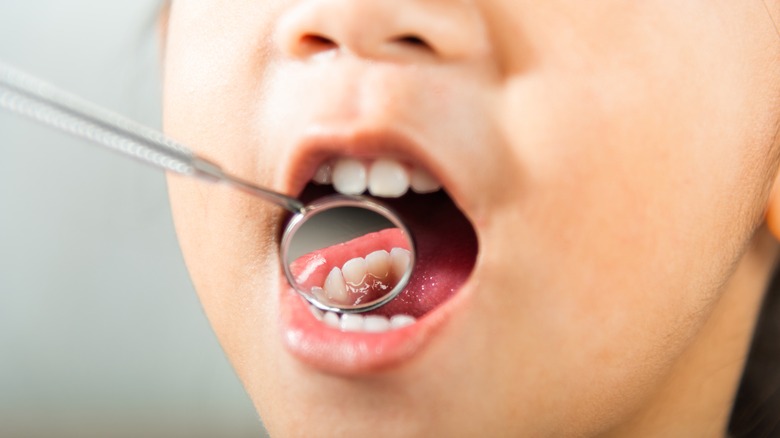 dentist examining asian kid's oral cavity