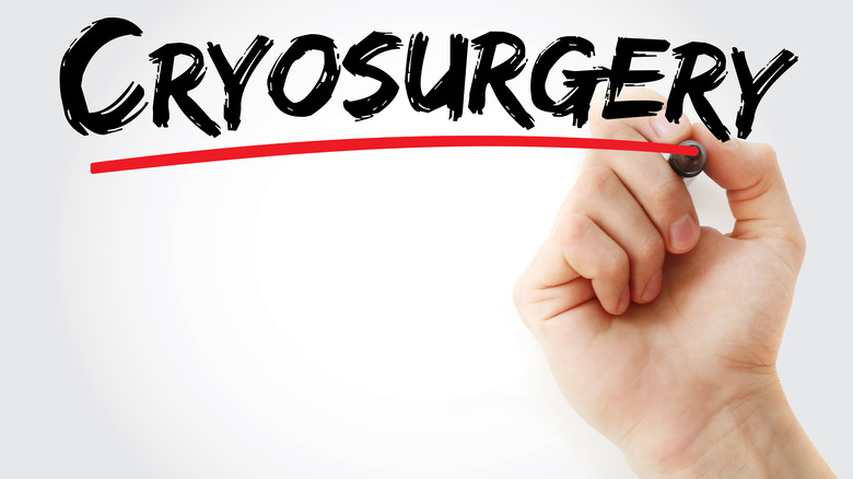 hand writing the word "cryosurgery" and underlining it