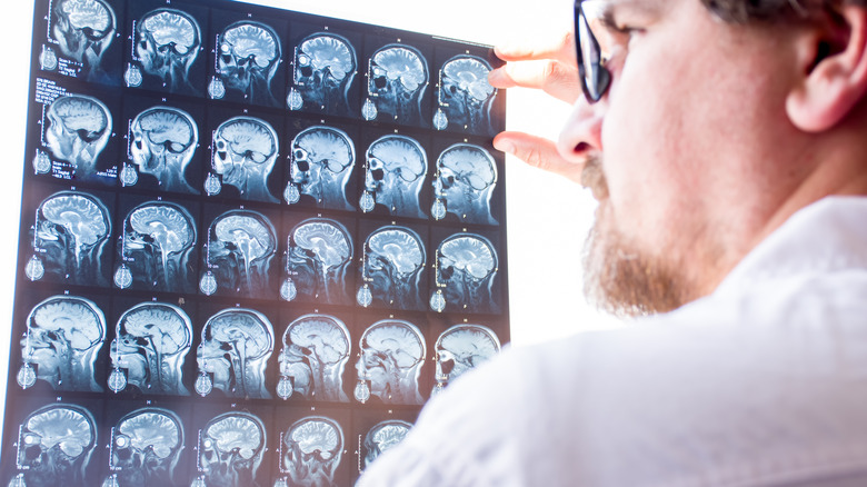 Doctor evaluates results of magnetic resonance imaging of brain in hospital 