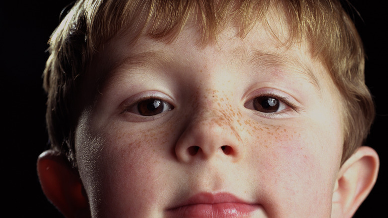 boy with freckles on his nose 