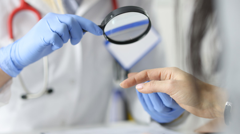 doctor inspecting patient's nails 