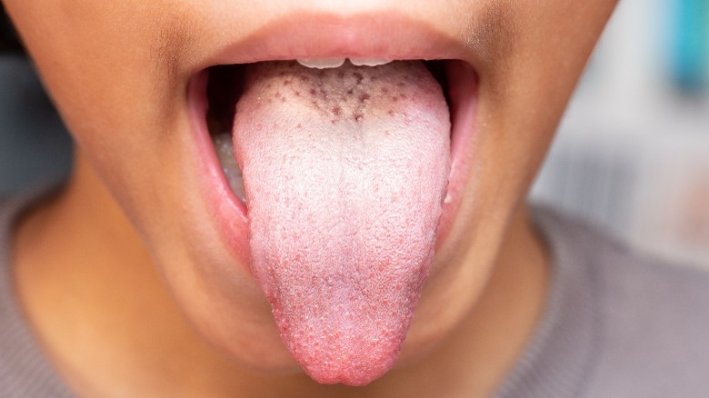 Tongue with bumps