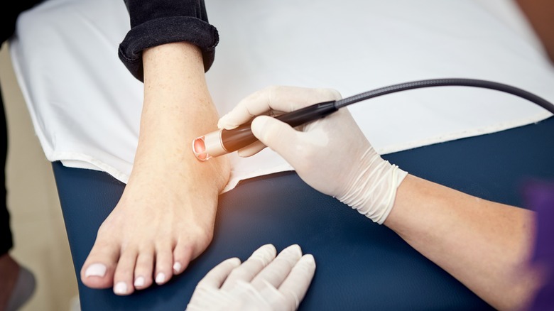 person receiving cold laser therapy for pain relief in foot