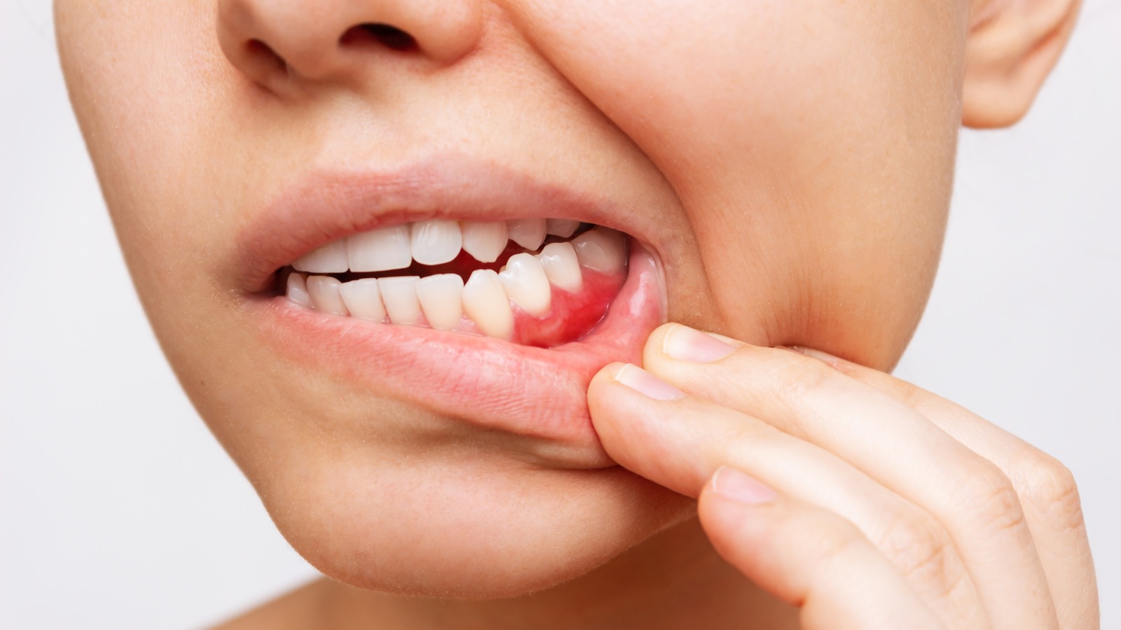 What Does It Mean When You Have Swollen Gums Around One Tooth 