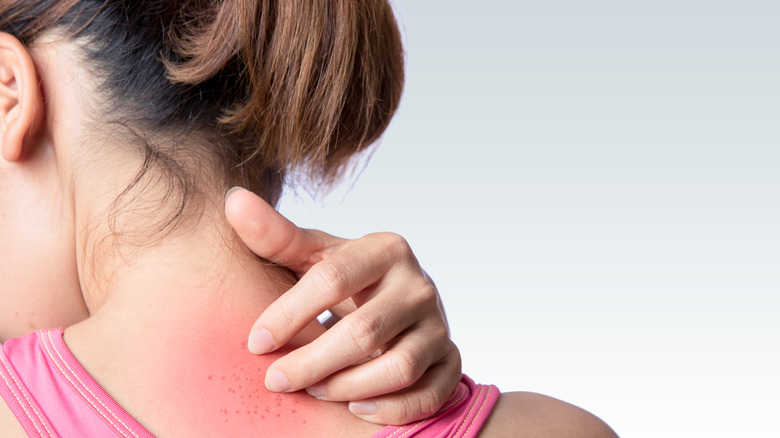 Woman scratching back of neck