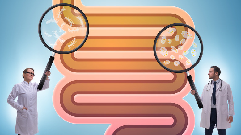 Illustration of large intestine 