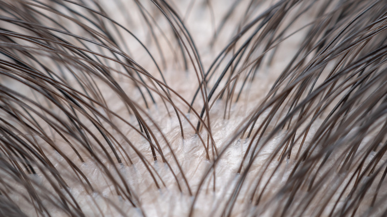 close up of hair roots