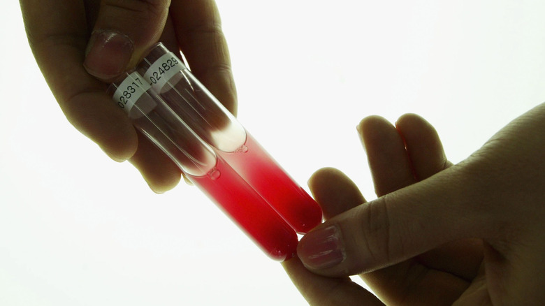 what-happens-if-you-are-given-the-wrong-blood-type-during-a-blood