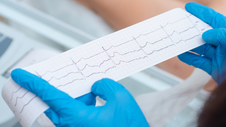 doctor with gloves reading EKG results